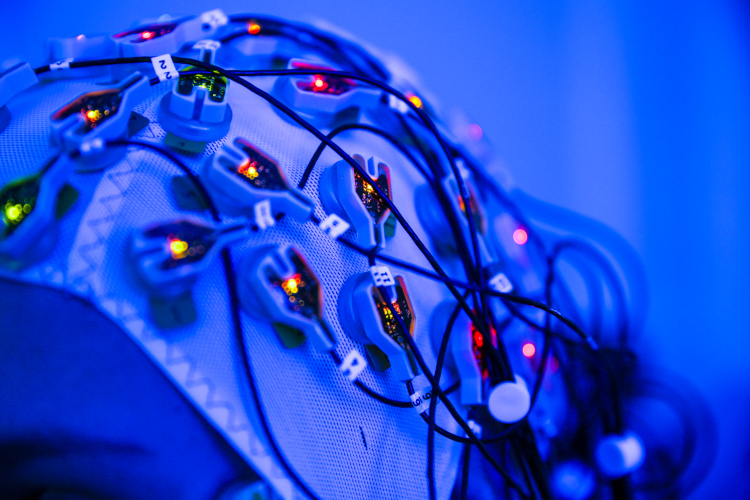 Nahaufnahme einer EEG-Kappe mit farbig leuchtenden Elektroden.