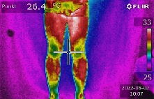 Thermografie Ergebnis