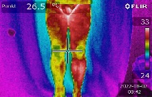 Thermografie Ergebnis