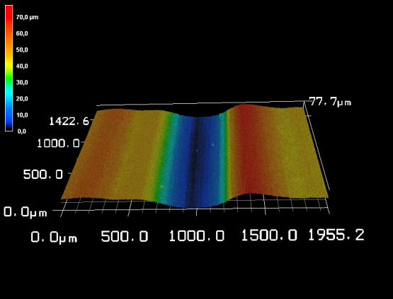 Laser Scanning Mikroskopie