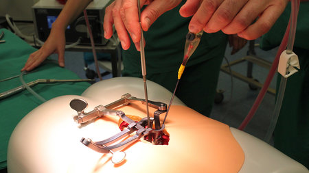 Mediziner hantieren mit Operationsbesteck an einem Wirbelsäulen-Modell