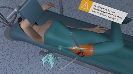 Grafik einer Hüftoperation an einem virtuellen Probanden.