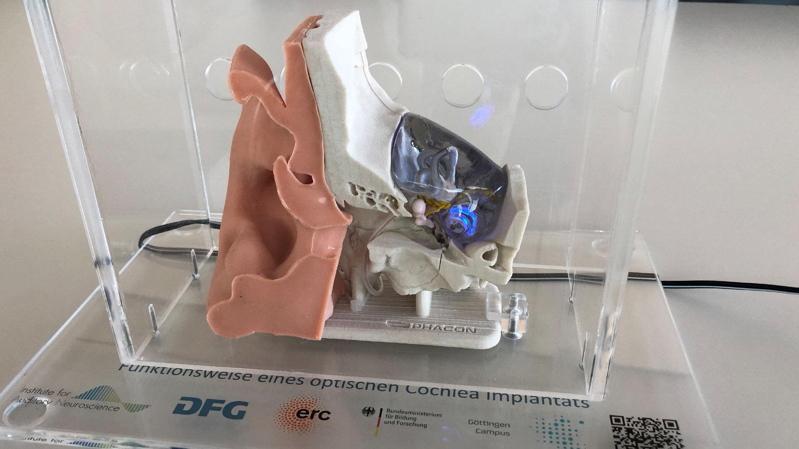 Modell einer Cochlea mit Prototyp des optischen Implantats.