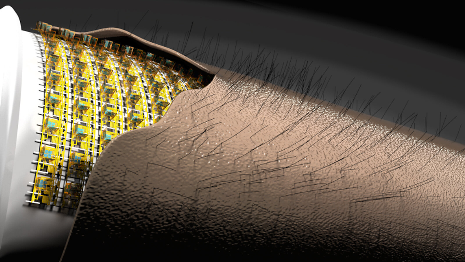 A hairy arm which shows sensor units beneath the skin.
